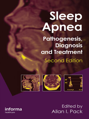 cover image of Sleep Apnea